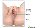 right hand presentation -                          Anterior vaginal wall repair (surgical treatment of urinary incontinence) - series