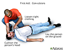Convulsions - first aid - series