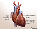right hand presentation -                          Heart bypass surgery - series - Normal anatomy