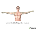 Muscle fatigue
