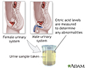 Citric acid urine test