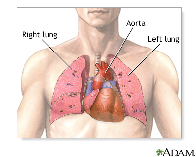 Heart-lung transplant - series - Normal anatomy