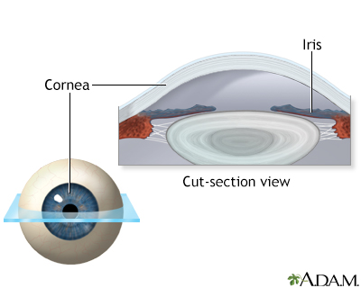 Lasik eye surgery - series - Normal anatomy