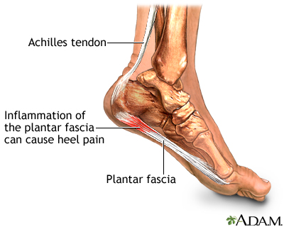 achilles heel pad walgreens