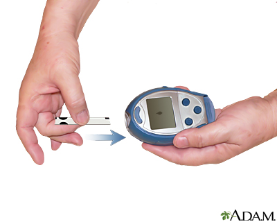 Monitoring blood glucose - Insert a test strip