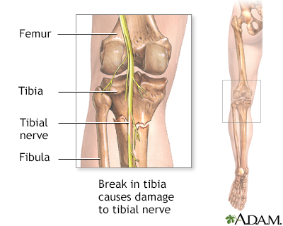 Tibial nerve