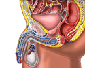 Enlarged prostate gland