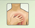 Cardiac arrhythmia: Heart palpitations and other symptoms